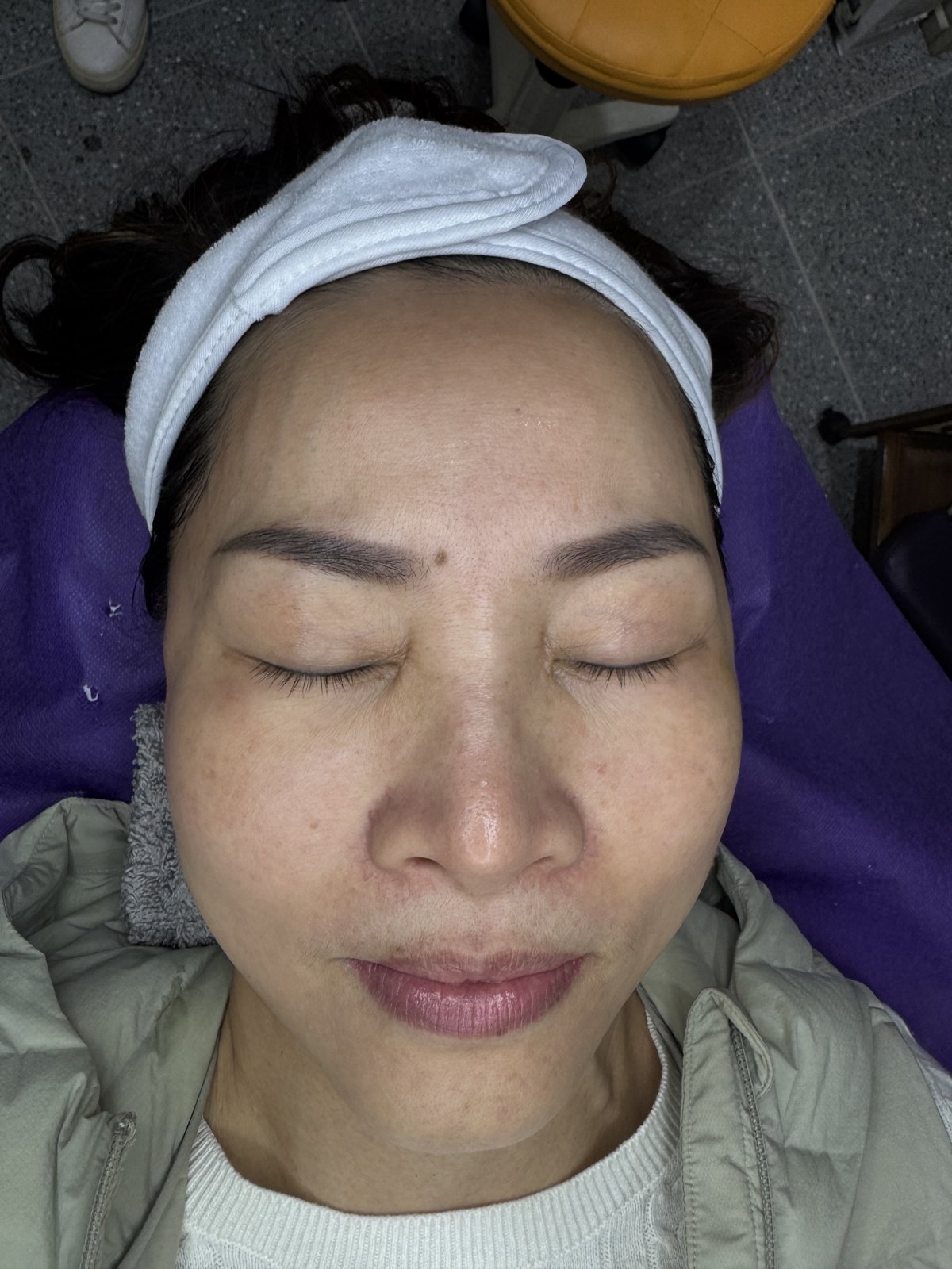 南投市種鑽石老師 療程前