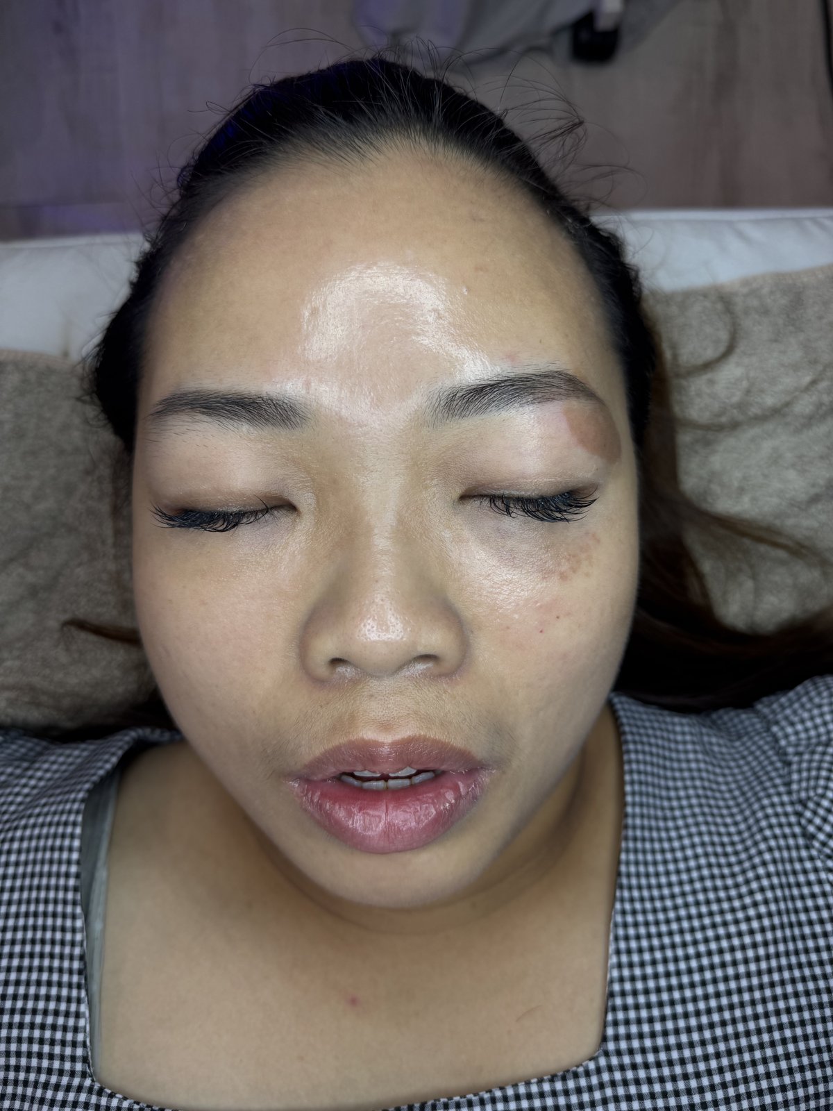Doris 療程後
