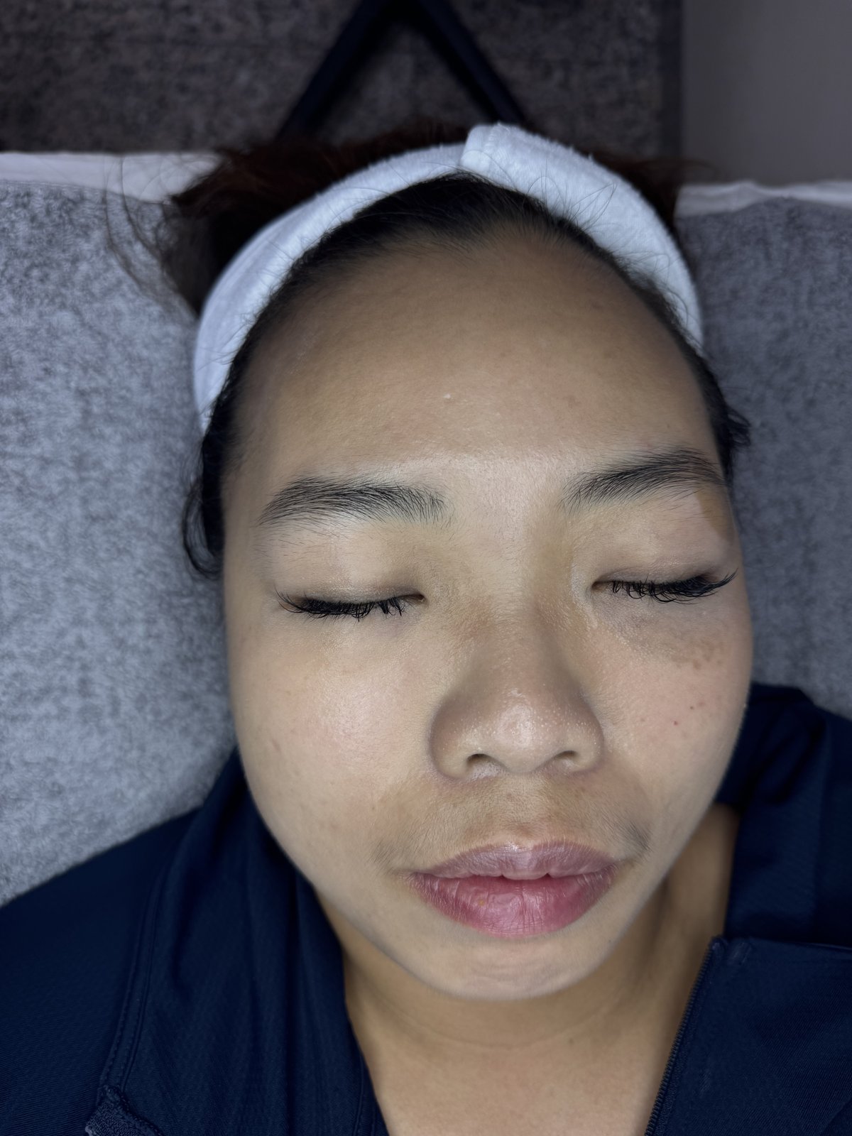 Doris 療程前